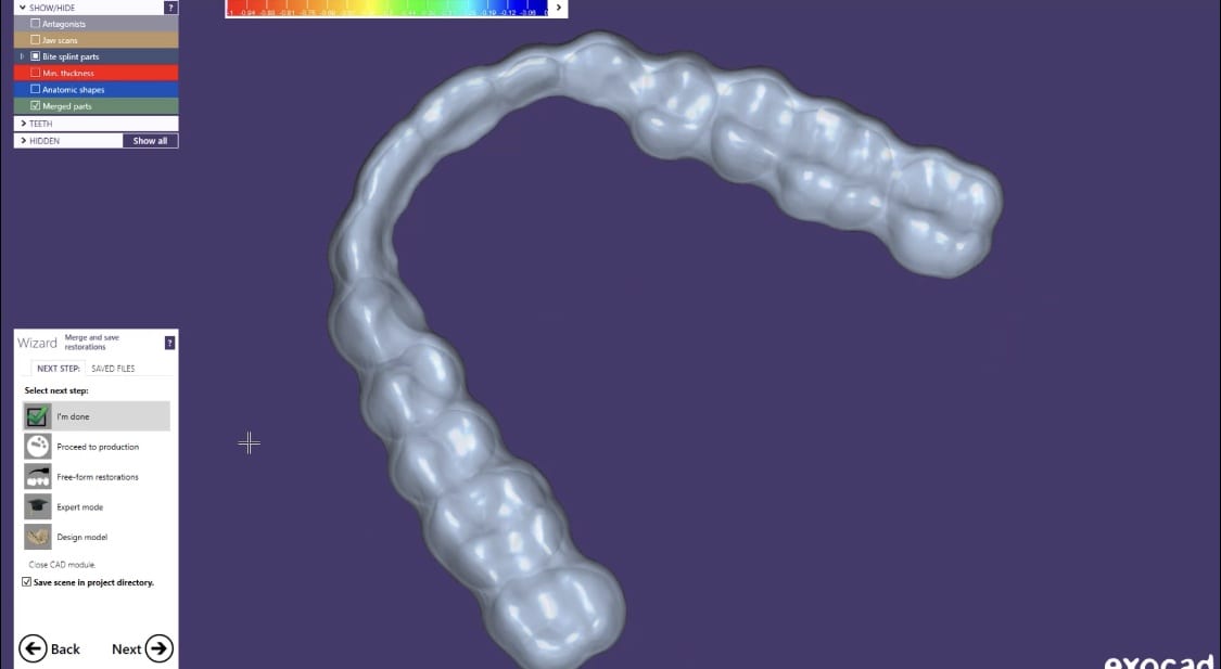 Digital Design and Milling of Occlusal Guard