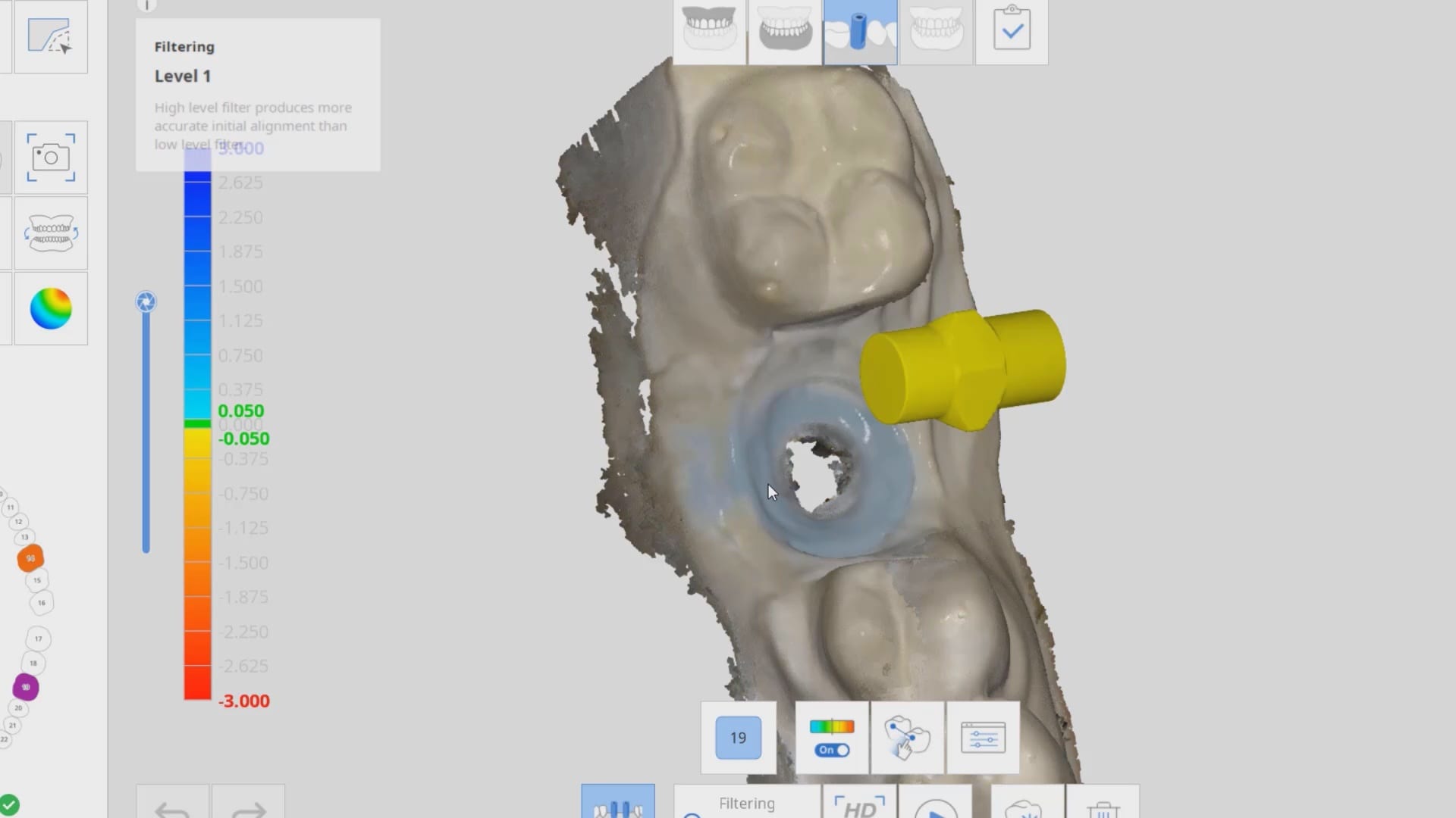 Video 1 - Setting Up the Medit i500 For The "Scanbody Drop"