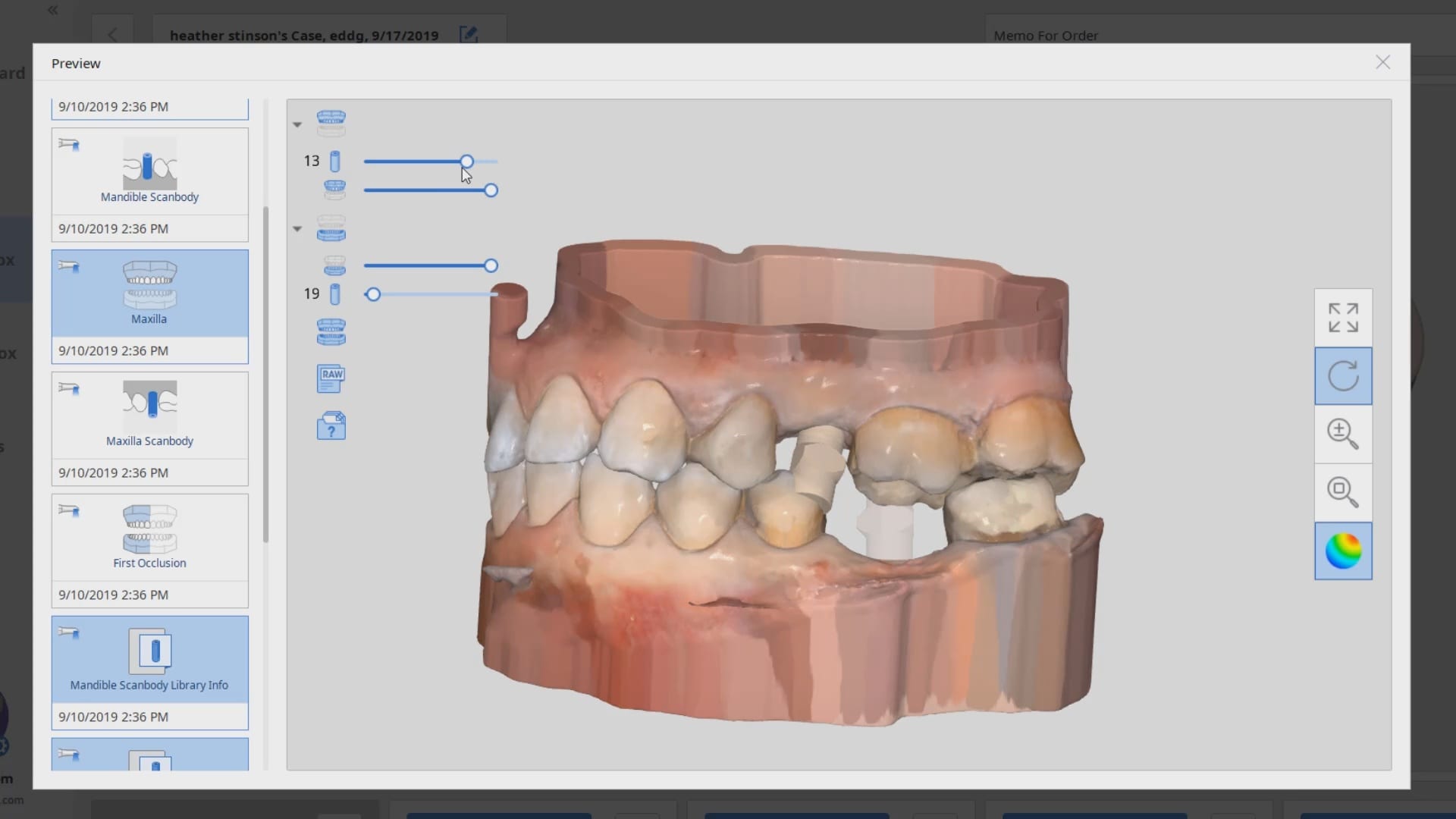 OXO Core Fit Dental Photogrammetry Unit for Digital Implant Impressions