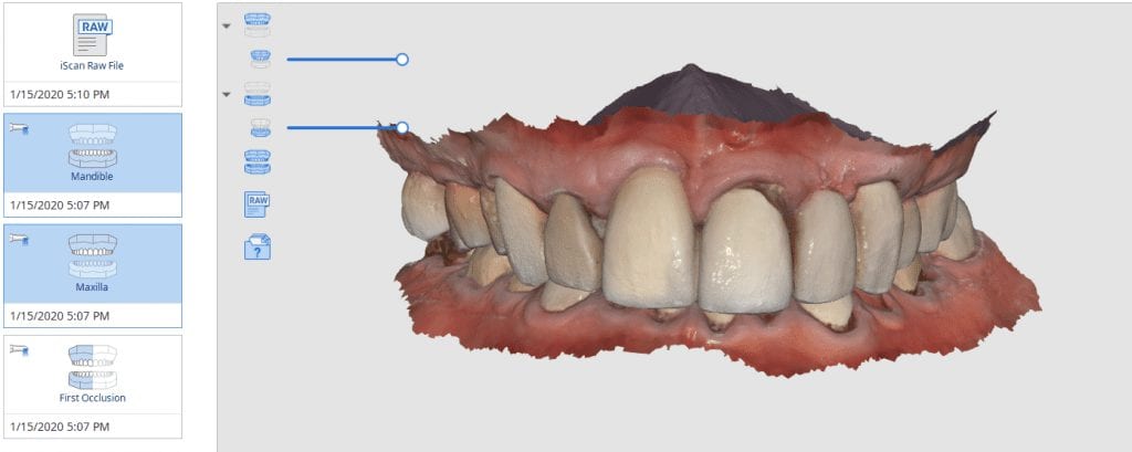 deep-bite | CAD-Ray.com