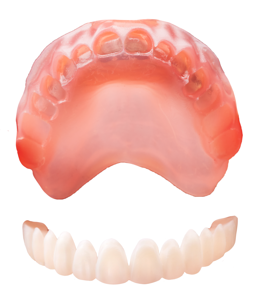 SprintRay In Office Dentures 90 Minute Workflow Mastery